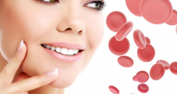 Vampire Facial | Skintellect