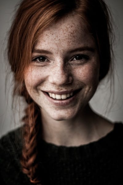 Freckles Lady 2019 | Skintellect