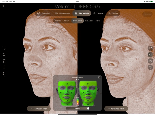 Aura 3d Imaging