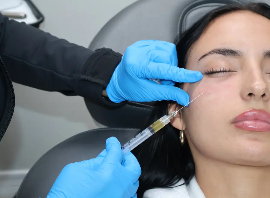 Patient receiving PRP injections at Skintellect Laser & Aesthetics in Tampa for skin rejuvenation and acne scar treatment